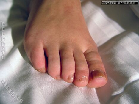 Scandinavian feet page leaked private photo uncensored HD quality
