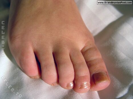 Scandinavian feet page leaked private photo uncensored HD quality