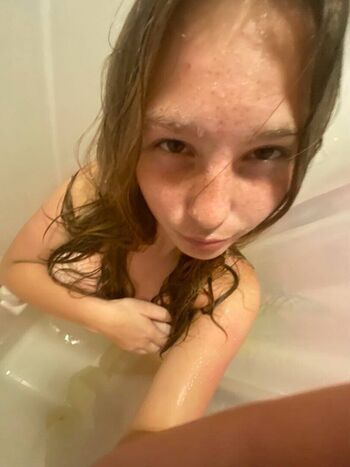 Skler leaked private photo uncensored HD quality